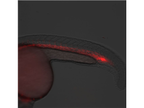 endothelial