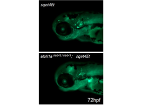 Loss of hair cell